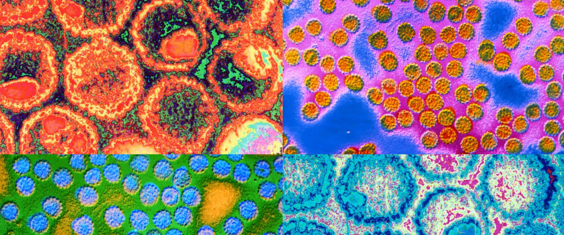 Everything You Need to Know About Sexually Transmitted Diseases (STDs)