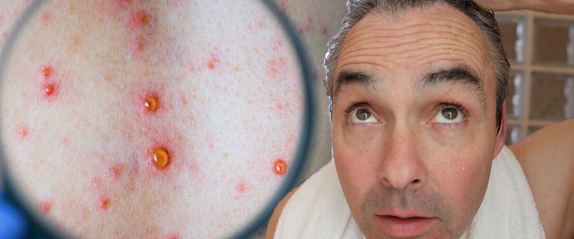 3 Sexually Transmitted Infections That Can Be Life-Threatening