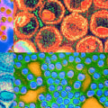 Everything You Need to Know About Sexually Transmitted Diseases (STDs)