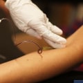 What are the Risks of Having an Untreated STD for Too Long?