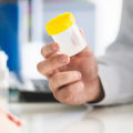 Can STD Symptoms Disappear?
