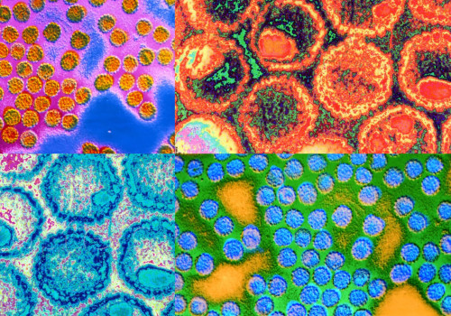 Everything You Need to Know About Sexually Transmitted Diseases (STDs)