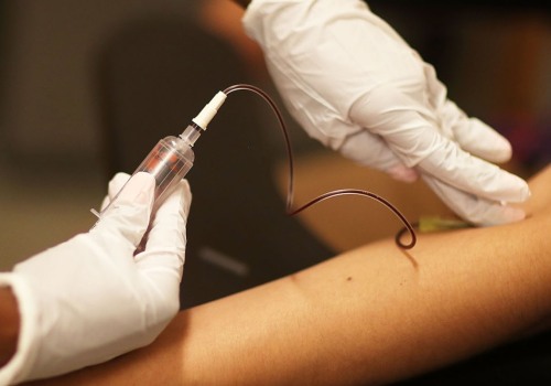 What are the Risks of Having an Untreated STD for Too Long?