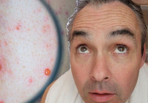3 Sexually Transmitted Infections That Can Be Life-Threatening